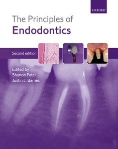 Principles of Endodontics