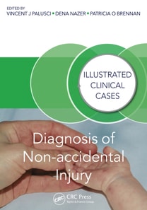 Diagnosis of Non-accidental Injury