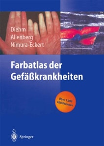 Farbatlas der Gefäßkrankheiten