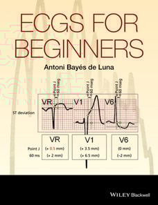ECGs for Beginners