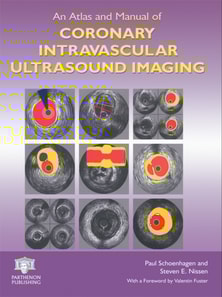 Atlas and Manual of Coronary Intravascular Ultrasound Imaging