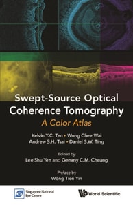 Swept-source Optical Coherence Tomography: A Color Atlas