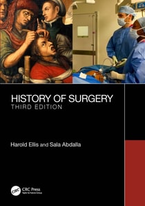 History of Surgery
