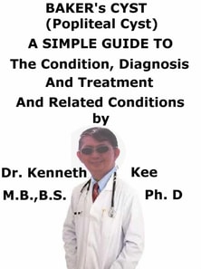 Baker's Cyst, (Popliteal Cyst) A Simple Guide To The Condition, Diagnosis, Treatment And Related Conditions
