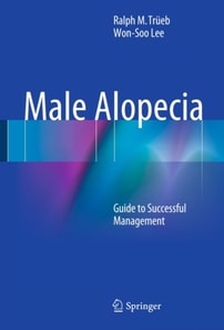 Male Alopecia