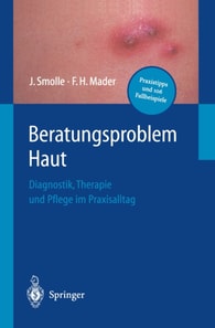Beratungsproblem Haut