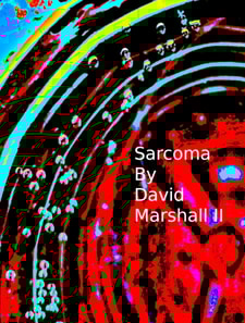 Sarcoma