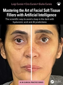 Mastering the Art of Facial Soft Tissue Fillers with Artificial Intelligence