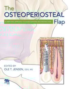 Osteoperiosteal Flap