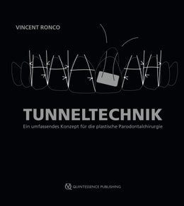 Tunneltechnik