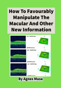 How To Favourably Manipulate The Macular  And Other New Information