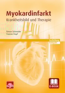Myokardinfarkt