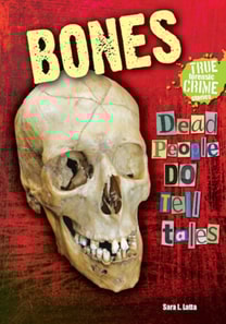 Bones