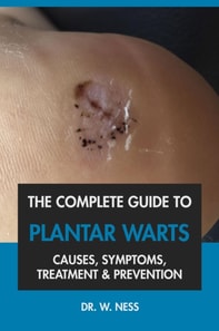Complete Guide to Plantar Warts: Causes, Symptoms, Treatment & Prevention