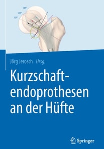 Kurzschaftendoprothesen an der Hüfte