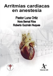 Arritmias cardiacas en anestesia