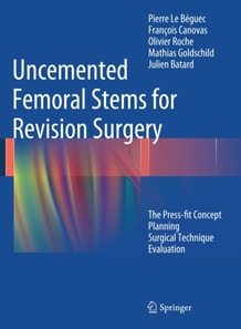 Uncemented Femoral Stems for Revision Surgery