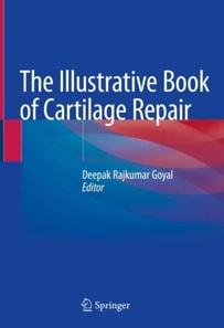 Illustrative Book of Cartilage Repair