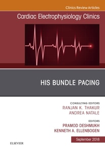 His Bundle Pacing, An Issue of Cardiac Electrophysiology Clinics