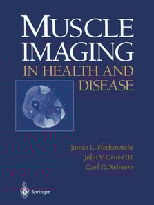 Muscle Imaging in Health and Disease