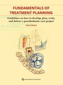 Fundamentals of Treatment Planning