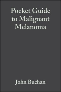 Pocket Guide to Malignant Melanoma