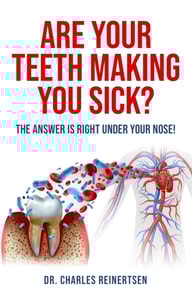 Are Your Teeth Making You Sick?