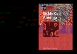 Sickle Cell Anemia