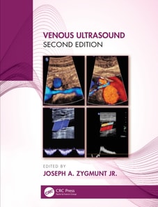 Venous Ultrasound