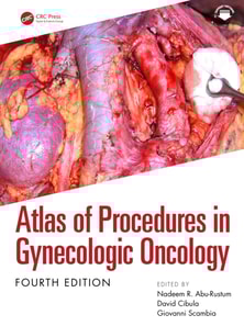 Atlas of Procedures in Gynecologic Oncology
