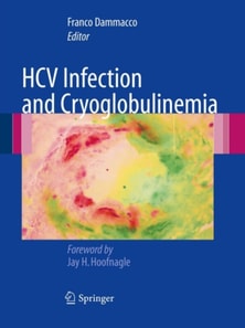 HCV Infection and Cryoglobulinemia