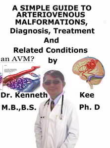 Simple Guide to Arteriovenous Malformations, Diagnosis, Treatment and Related Conditions