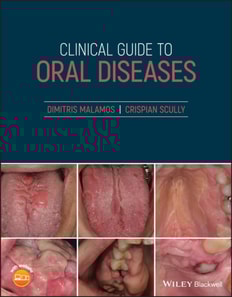 Clinical Guide to Oral Diseases