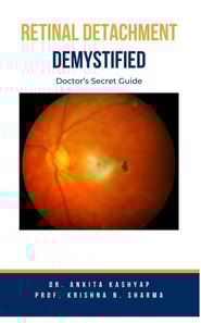 Retinal Detachment Demystified: Doctor's Secret Guide