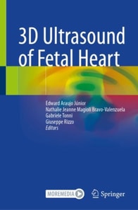 3D Ultrasound of Fetal Heart