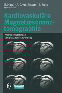 Kardiovaskuläre Magnetresonanztomographie