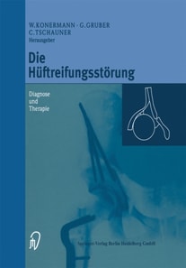 Die Hüftreifungsstörung