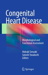 Congenital Heart Disease