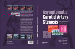 Asymptomatic Carotid Artery Stenosis