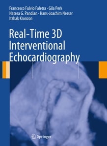 Real-Time 3D Interventional Echocardiography