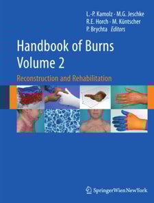 Handbook of Burns Volume 2