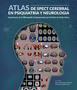 Atlas de spect cerebral en psiquiatria y neurologia