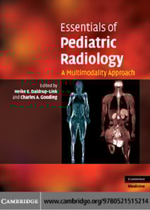Essentials of Pediatric Radiology