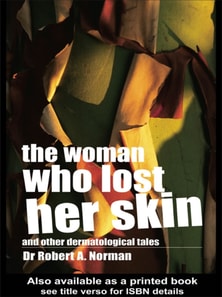 Woman Who Lost Her Skin