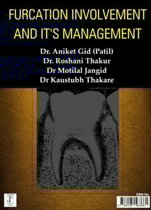 Furcation Involvement and It's Management