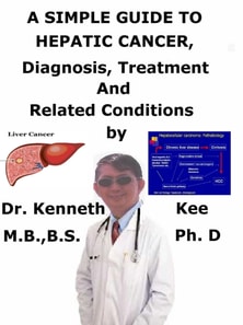 Simple Guide to Hepatic Cancer, Diagnosis, Treatment and Related Conditions