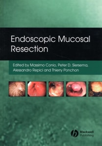 Endoscopic Mucosal Resection