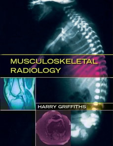 Musculoskeletal Radiology