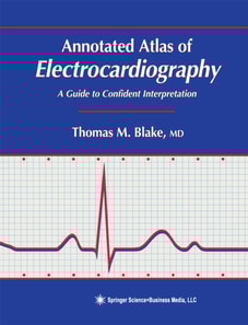 Annotated Atlas of Electrocardiography