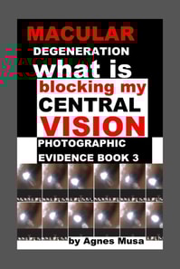 Macular Degeneration, What Is Blocking My Central Vision, Photographic Evidence Book 3